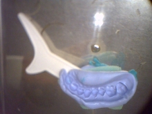 Double arch impression tray incorrectly placed