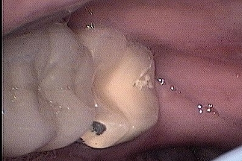 DO IT ONCE – DO IT RIGHT